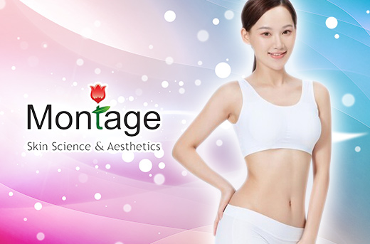 30-Minute Emsculpt with RF Neo Treatment at Montage Tomas Morato in QC